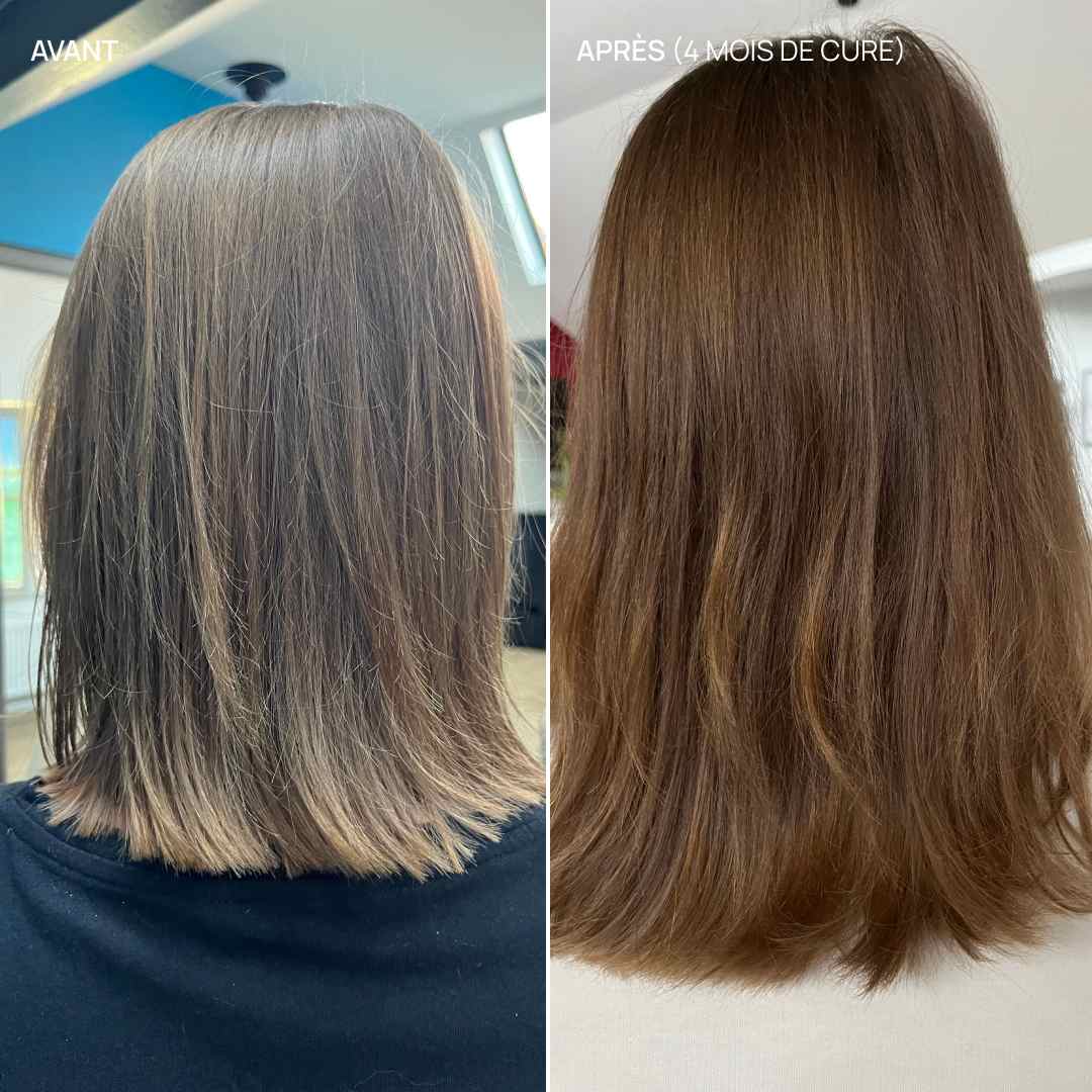 Complément alimentaire cheveux, Hair & Scalp Boost