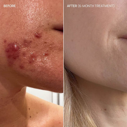 Hormonal supplement, Balance & Glow 15