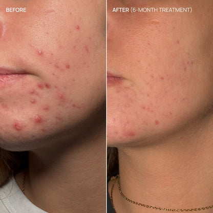 Hormonal supplement, Balance & Glow 20