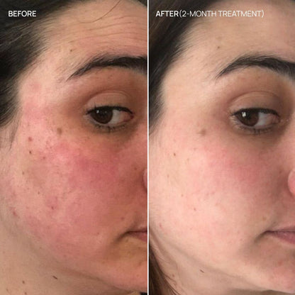 Redness and sensitivity supplement, French Glow 12