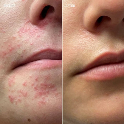 Redness and sensitivity supplement, French Glow 14