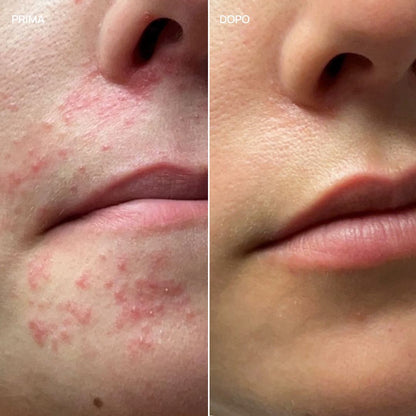 Integratore alimentare pelle arrossata e sensibile, French Glow 19