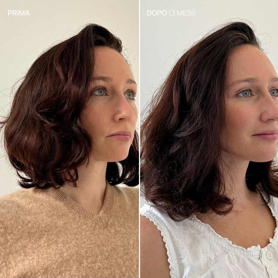 Integratore alimentare per capelli, Hair & Scalp Boost 